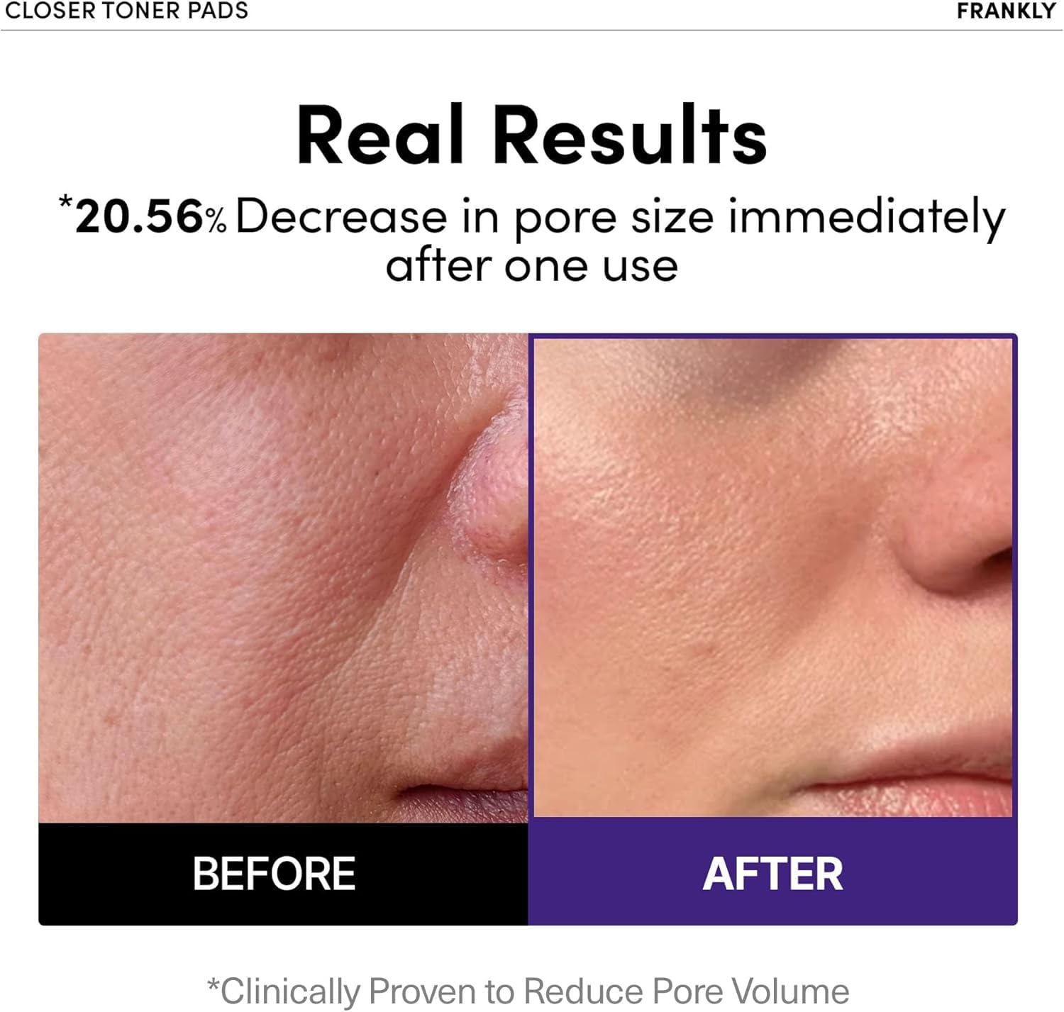 FRANKLY close-up of pad texture highlighting smooth fiber and hydrated serum benefit