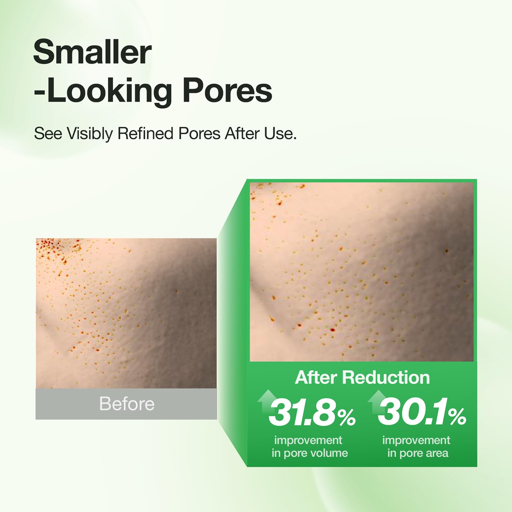 FULLY model applying mask on T-zone for targeted oil control