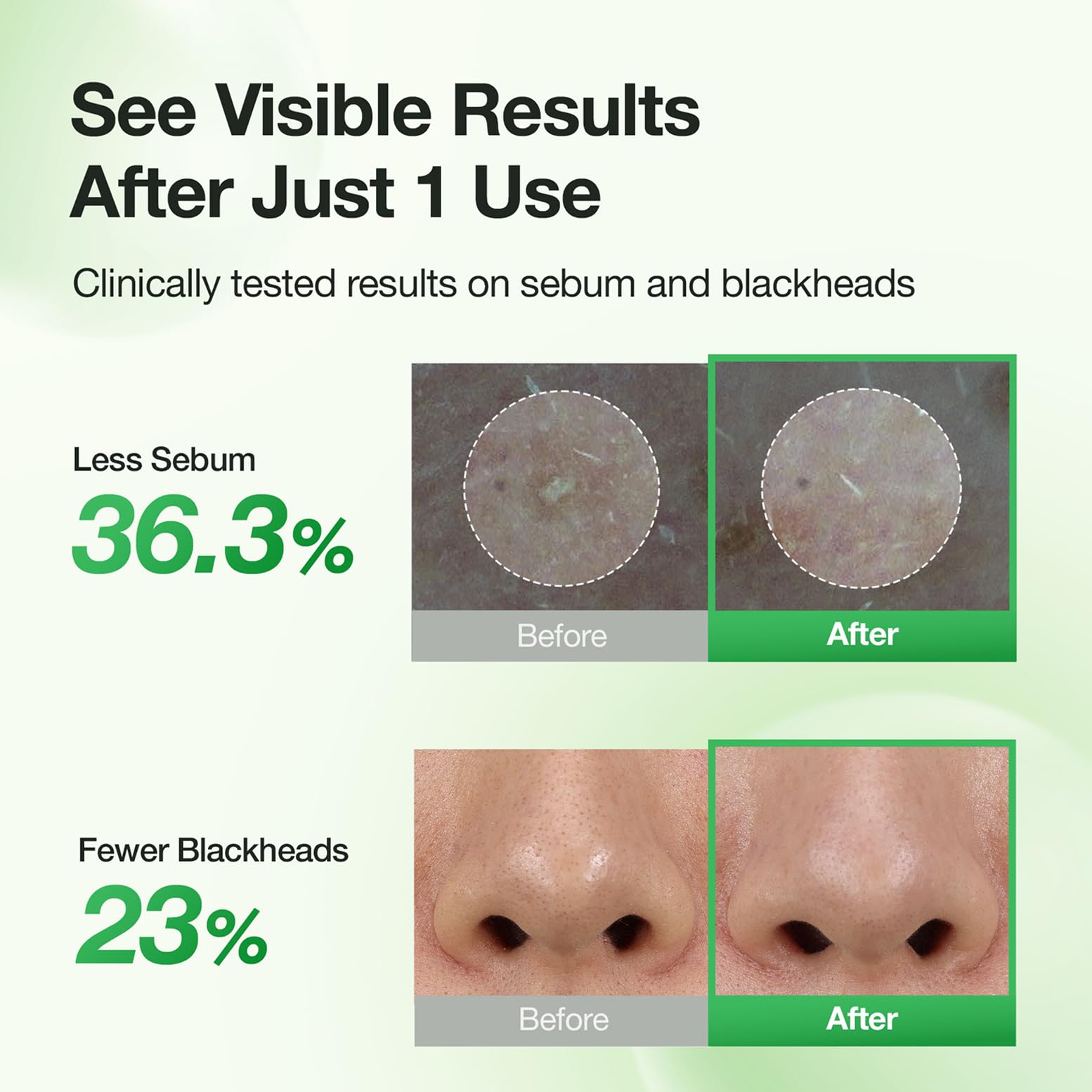 FULLY peeled sheet showing lifted sebum and clearer pores
