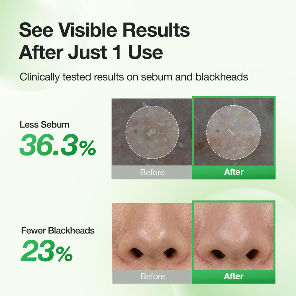 FULLY peeled sheet showing lifted sebum and clearer pores
