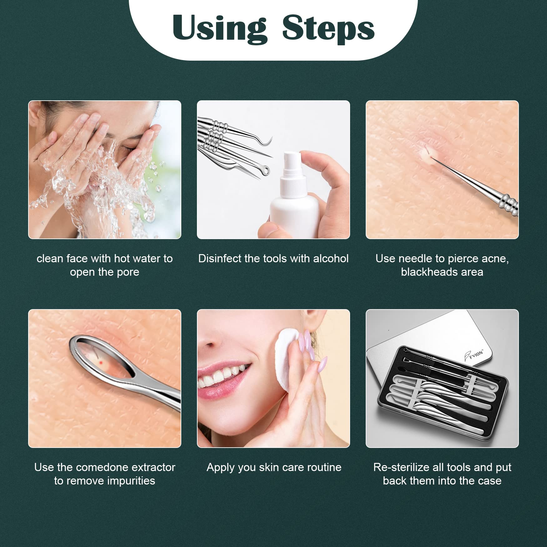 FVION hand-held demonstration using loop extractor for safer, controlled blemish removal benefit