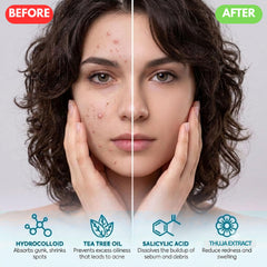 Generic brand application demo on hand showing effortless peel-and-apply use