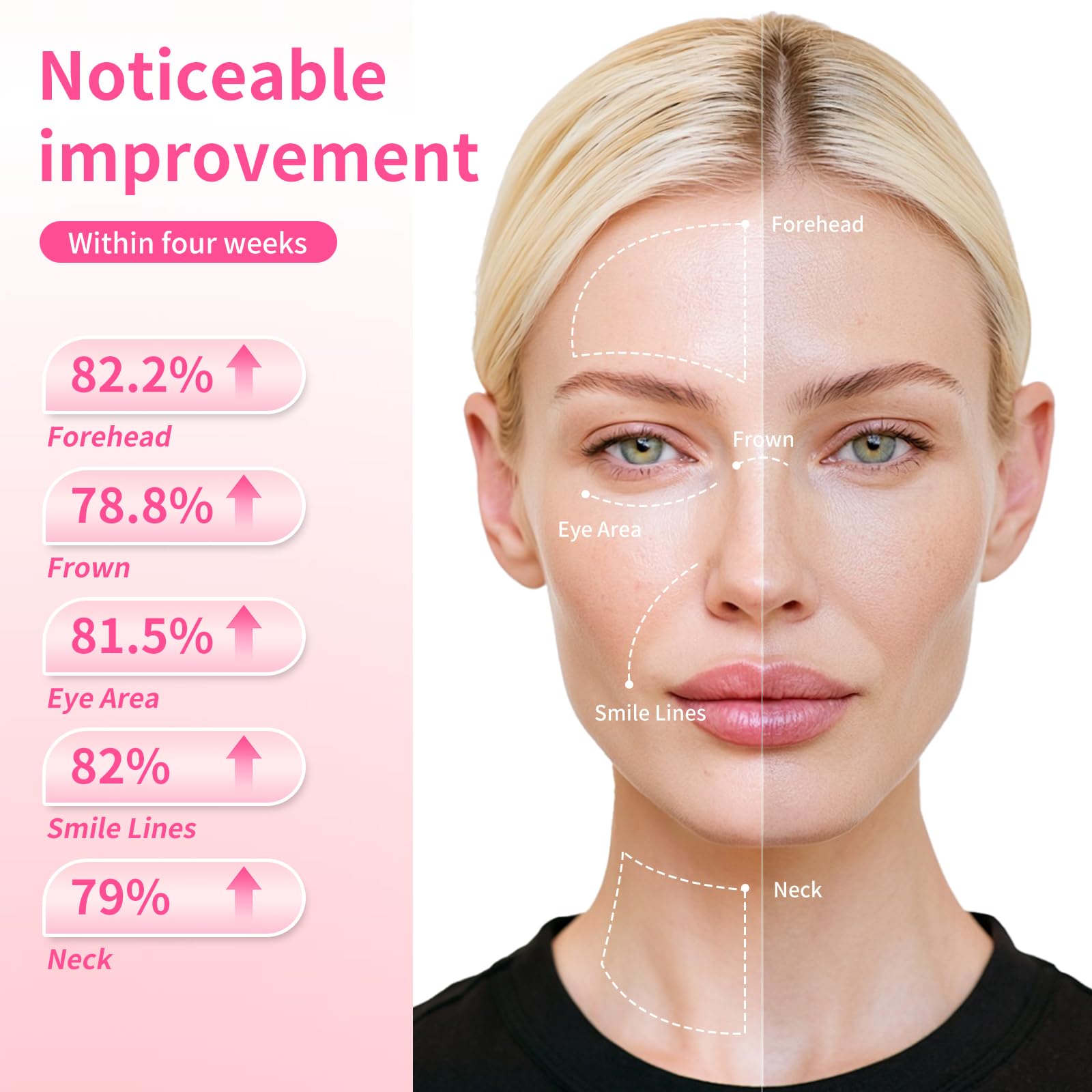Generic PDRN used on neck area showing targeted coverage and improved skin feel benefit