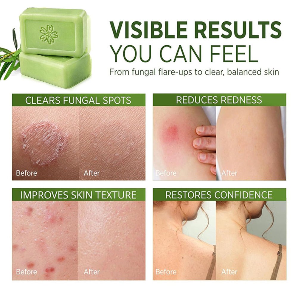 glo7 skinCare ingredient label close-up showing tea tree oil inclusion