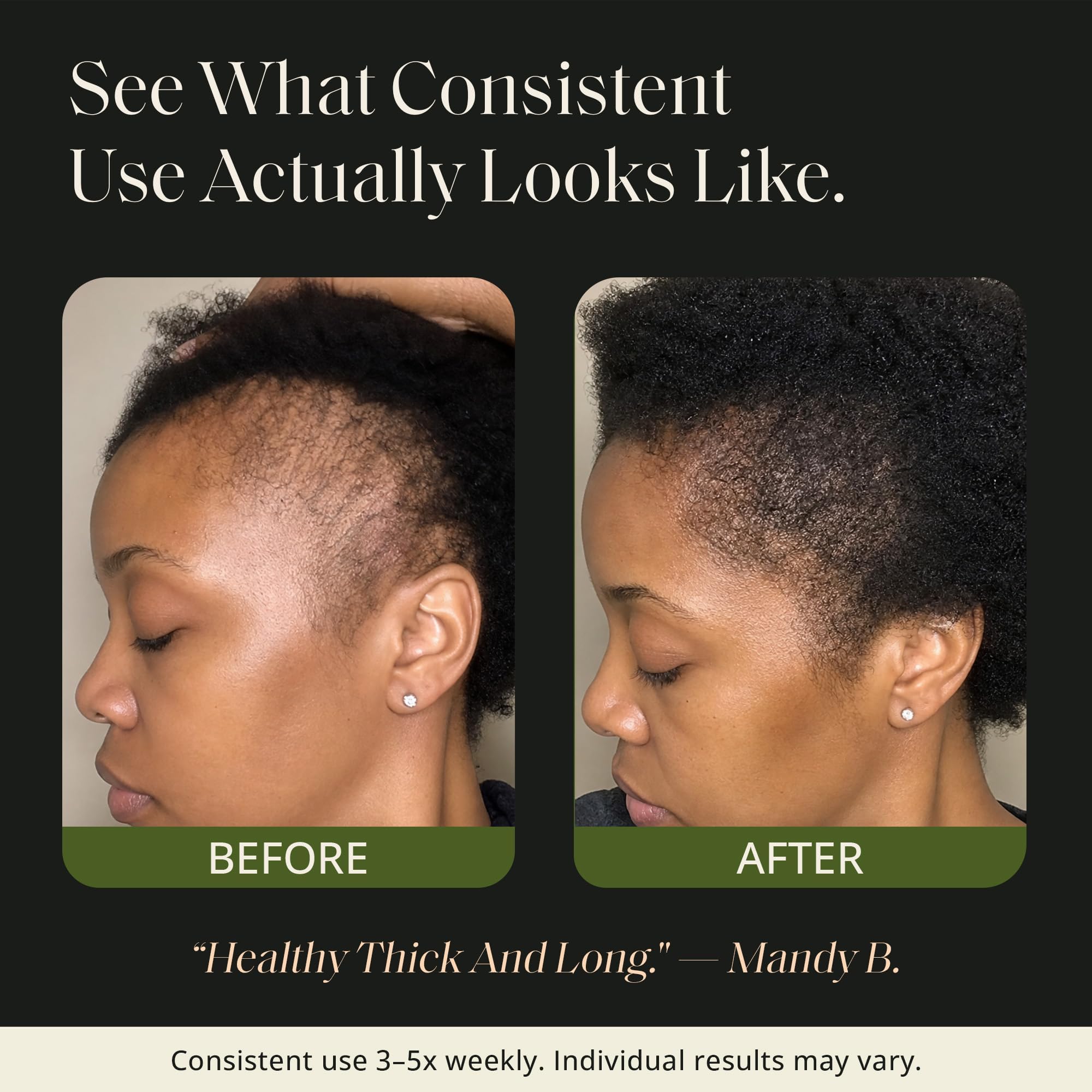 Glossed by Nae bottle next to a ruler for 4 fl oz scale and travel-friendly sizing benefit