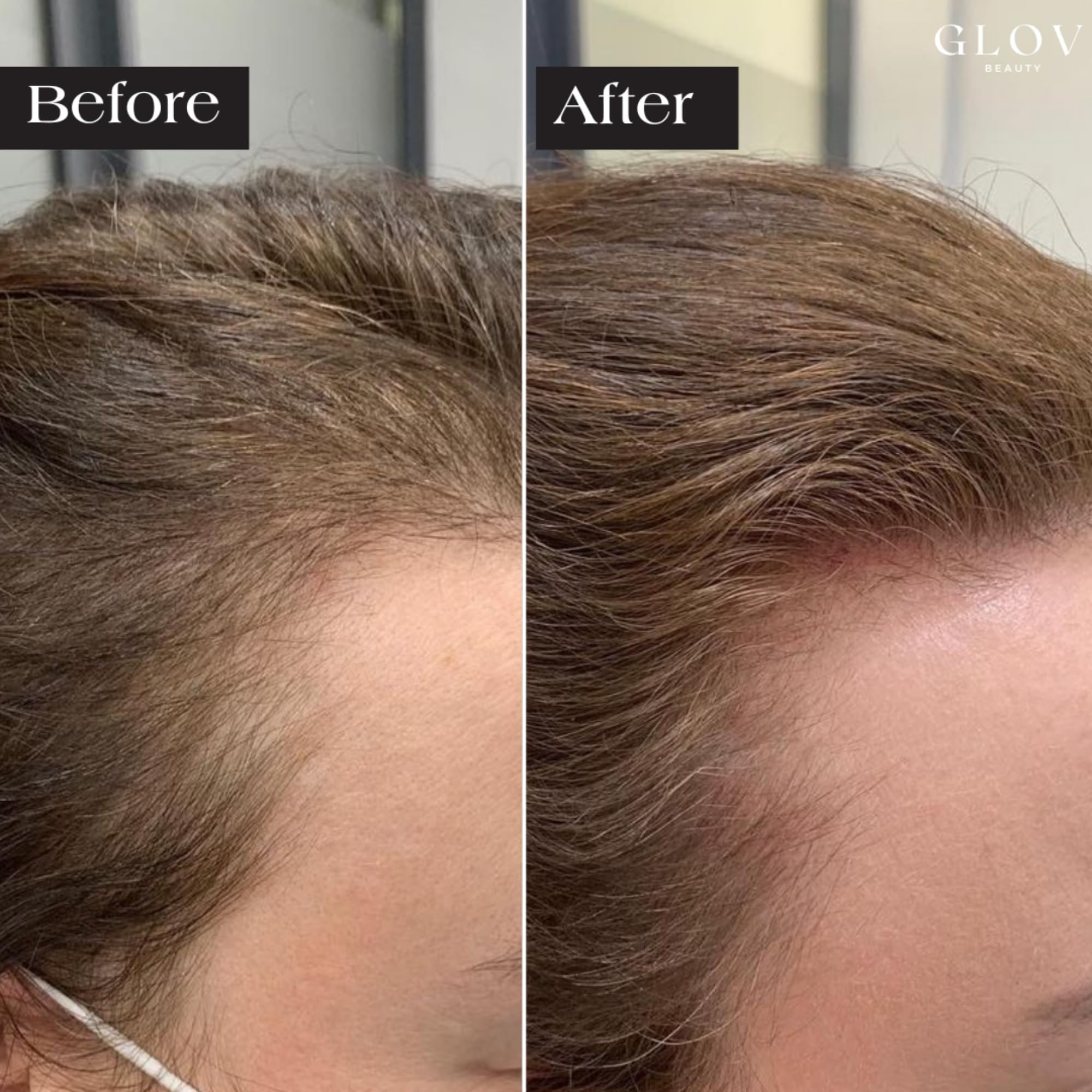 Glov Beauty peptide and hyaluronic serum ampoules lined for targeted hydration