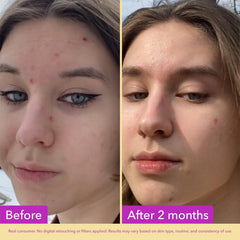 Good Molecules serum texture on hand, lightweight absorbent finish benefit