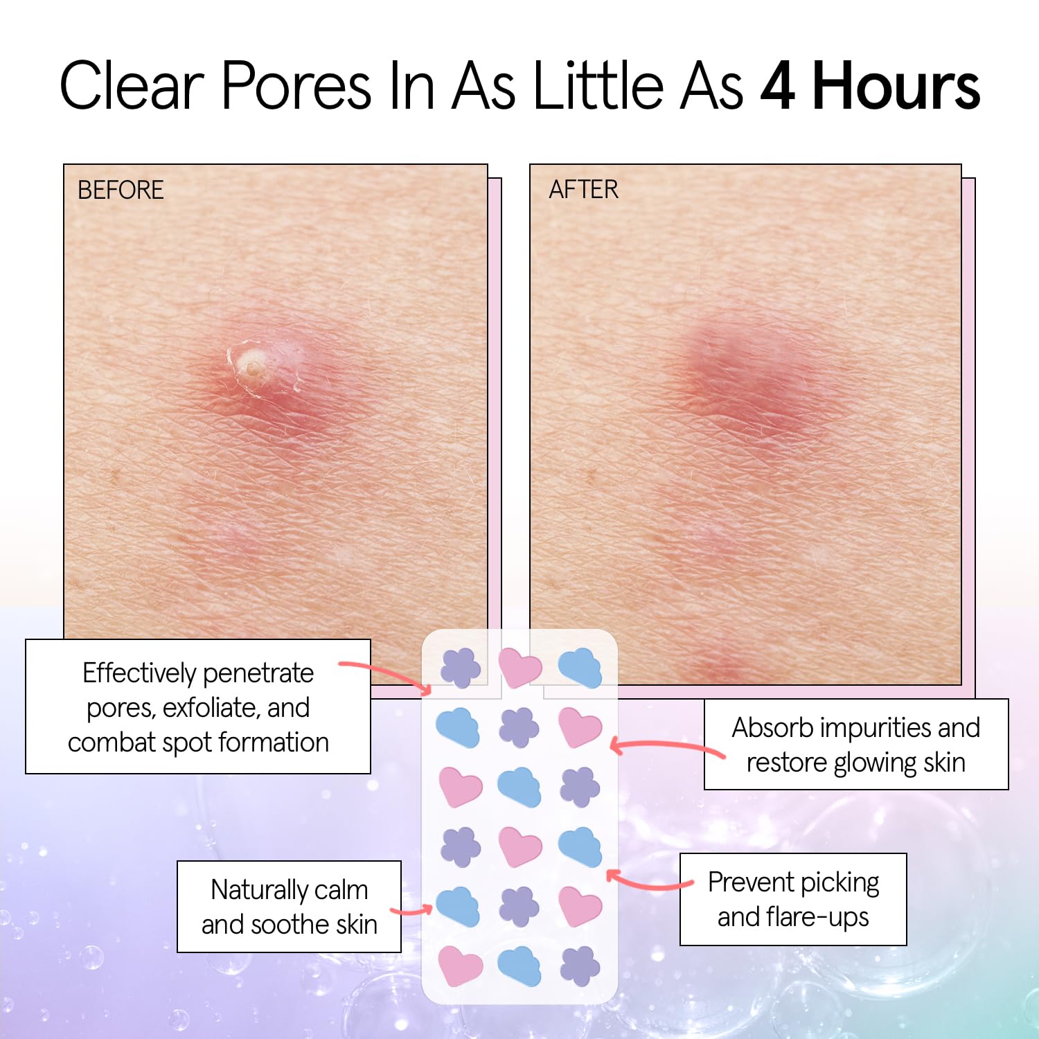 grace & stella patch applied to cheek, discreet coverage for confidence