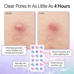 grace & stella patch applied to cheek, discreet coverage for confidence