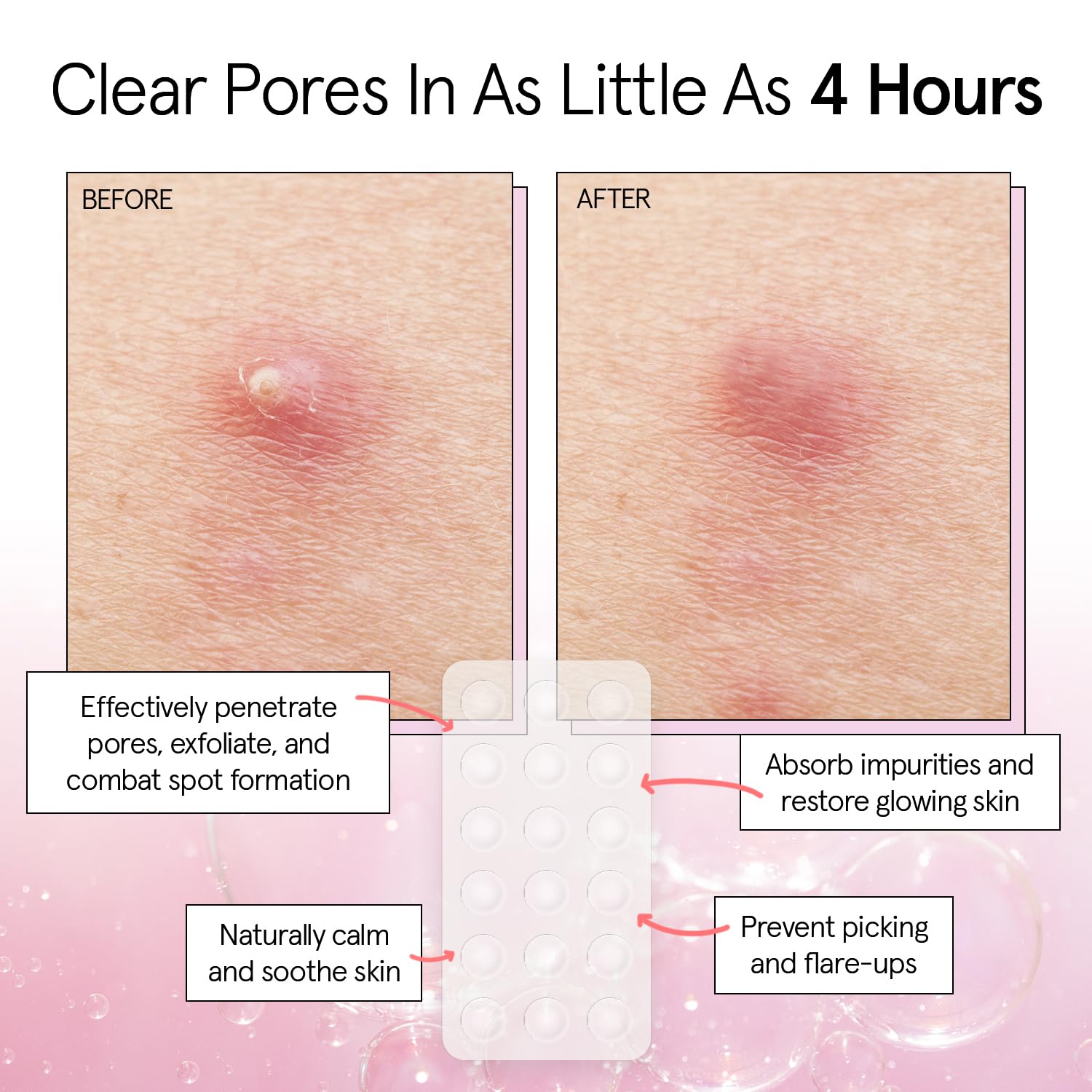 grace & stella patch applied to cheek showing discreet coverage and protection