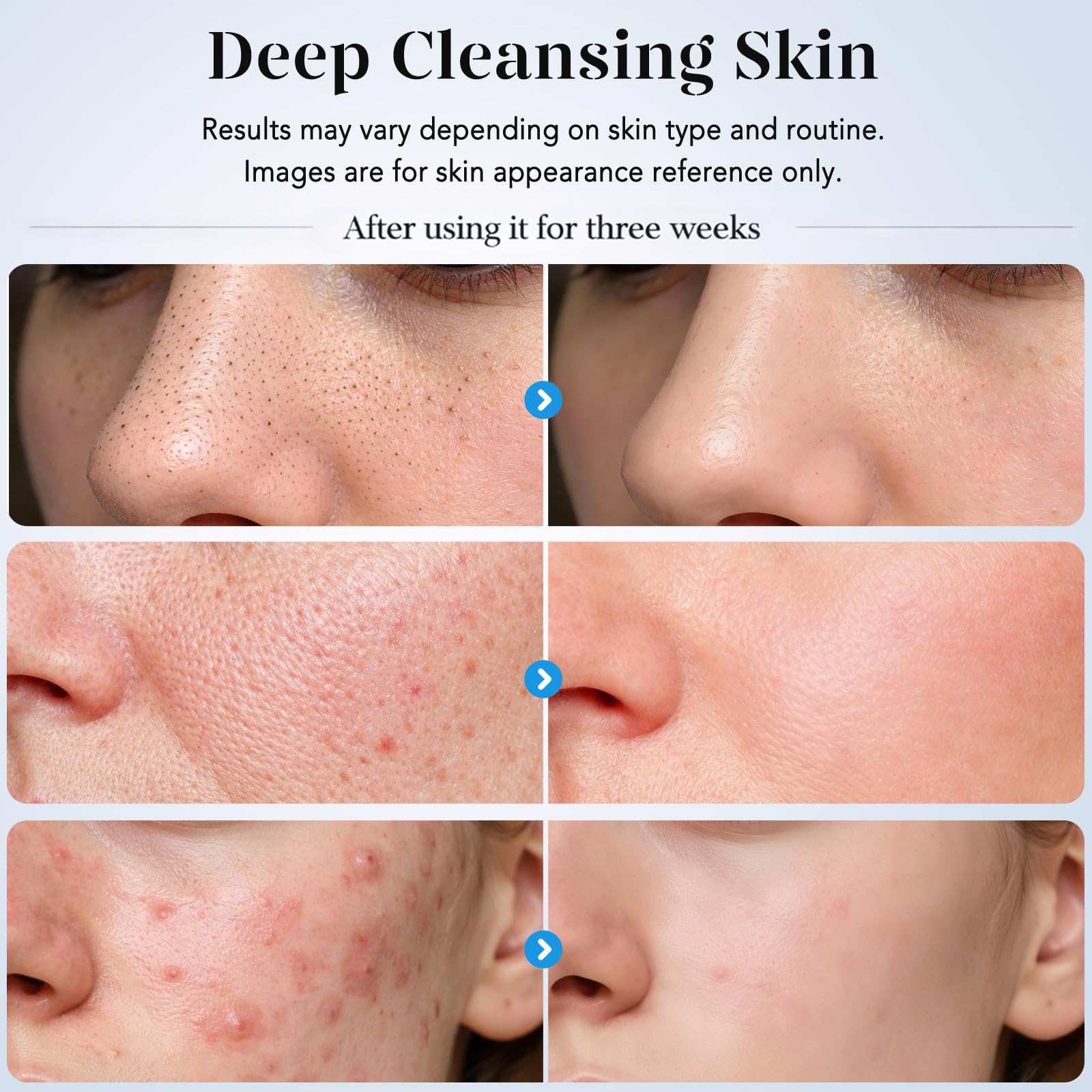 GUGUG spatula in use on damp cheek demonstrating deep-clean pore benefit