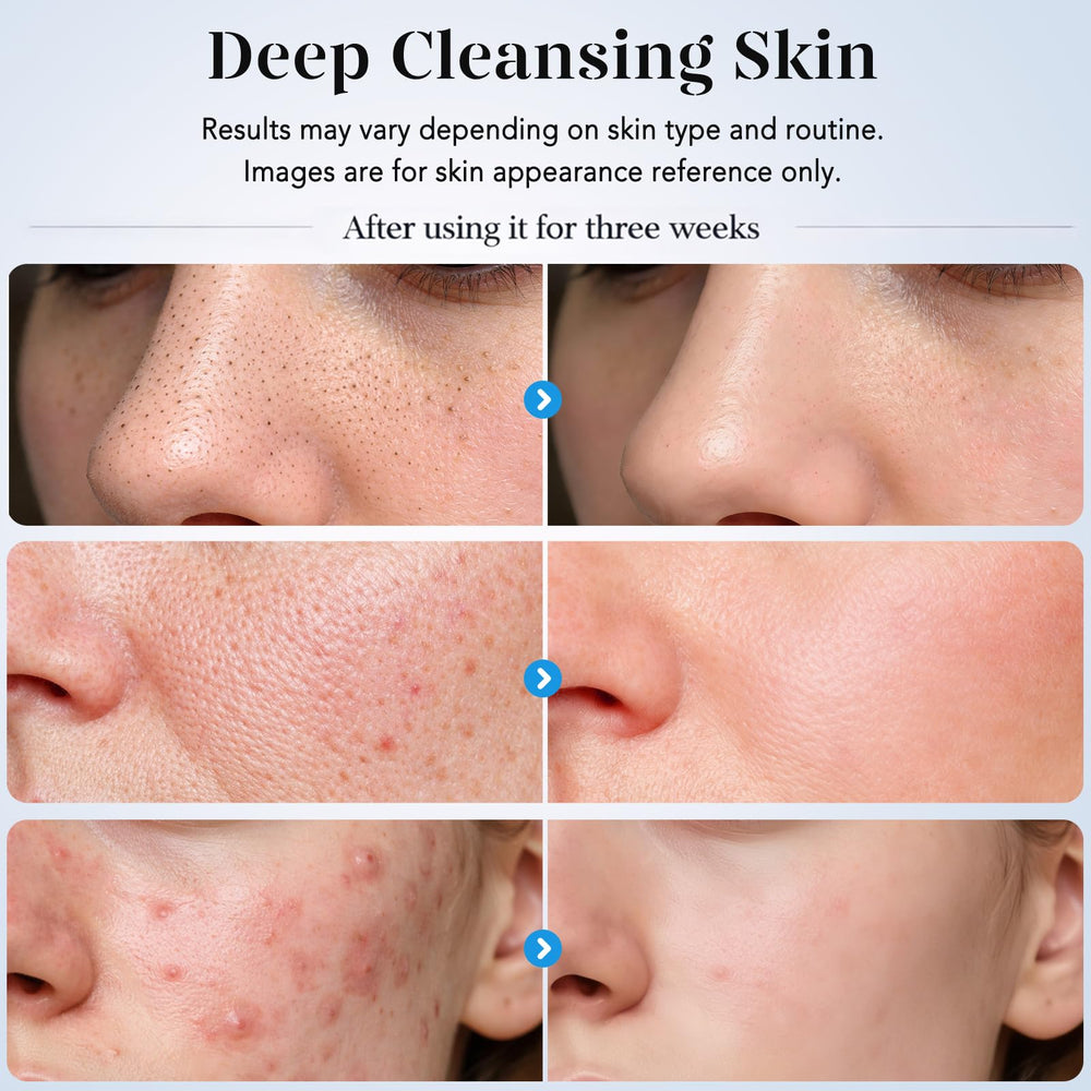 GUGUG spatula in use on damp cheek demonstrating deep-clean pore benefit