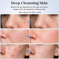 GUGUG spatula in use on damp cheek demonstrating deep-clean pore benefit