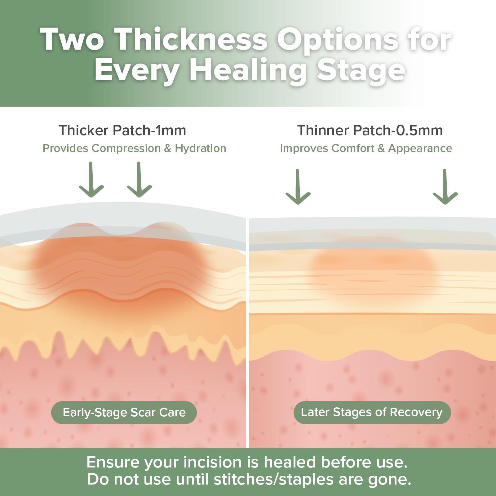 haakaa applied to a healing C-section scar demonstrating coverage