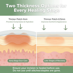 haakaa applied to a healing C-section scar demonstrating coverage