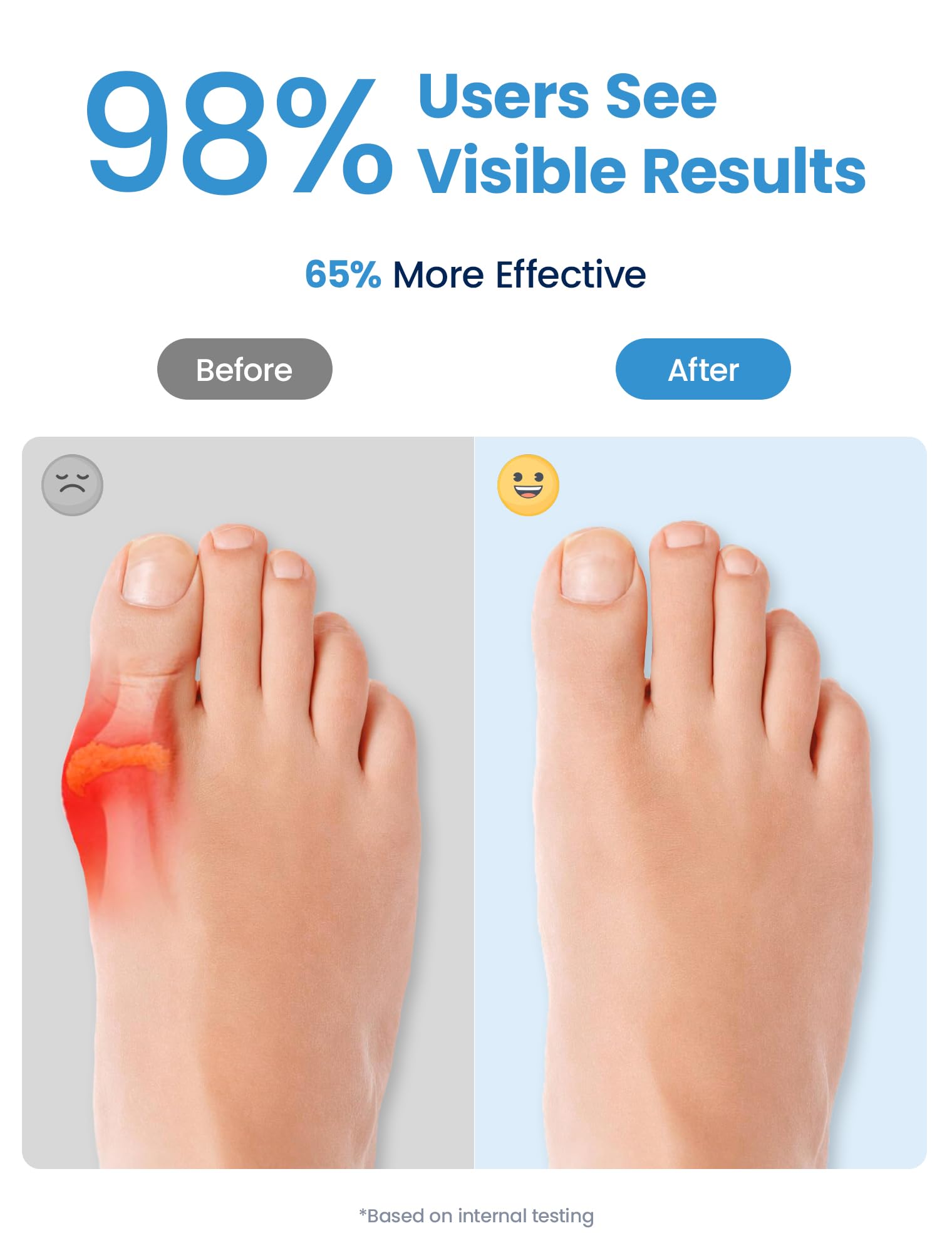 Habioer close-up of triple-toe alignment demonstrating stable three-point support
