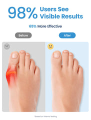 Habioer close-up of triple-toe alignment demonstrating stable three-point support