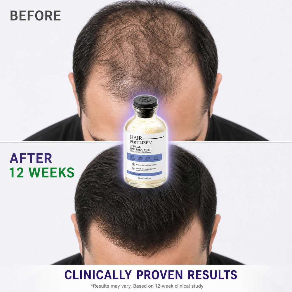 HAIR FERTILIZER 2oz bottle in hand showing compact travel-friendly size