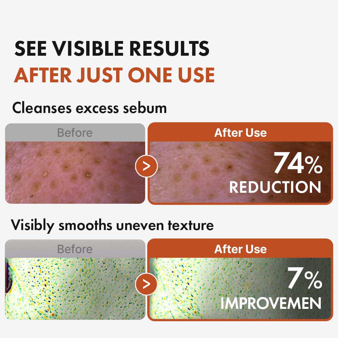 Hanskin oil texture on hand demonstrating lightweight spreadable cleansing benefit