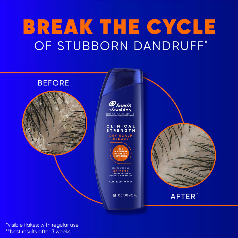 Head & Shoulders shampoo and conditioner paired on shelf for full routine
