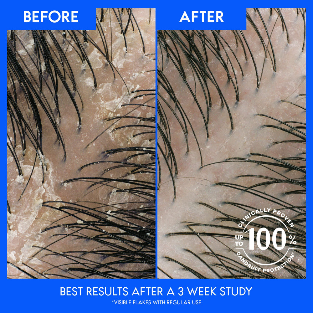 Head & Shoulders creamy texture closeup highlighting conditioning formula for softness