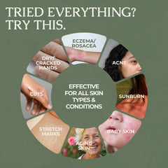 Hearth and Homestead balm being applied to hands for quick hydration