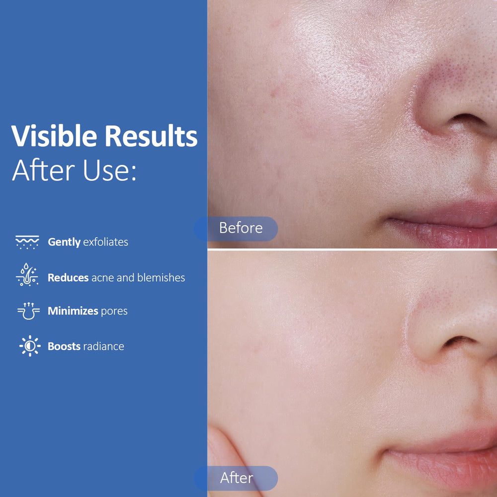 Hicream pad soaked in solution displaying active acids and hydrating ingredients for balanced care