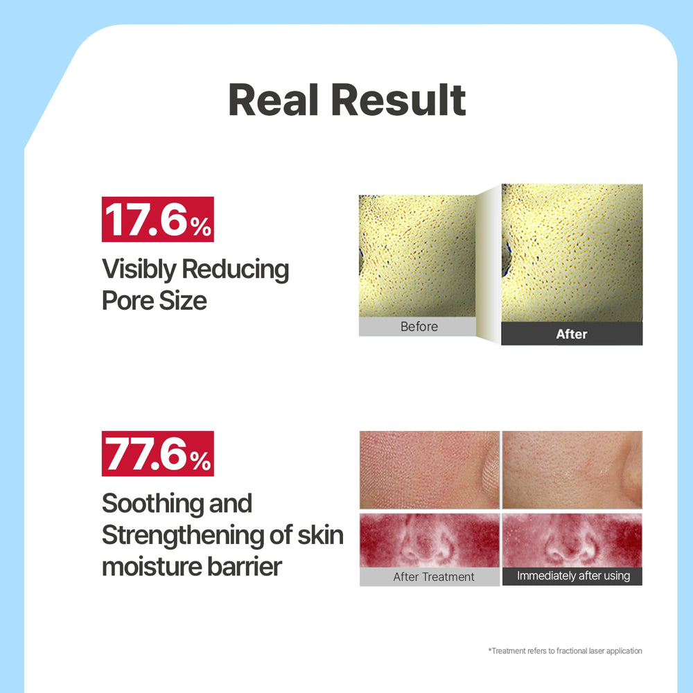 Illiyoon essence droplet on fingertip highlighting concentration and fast absorption