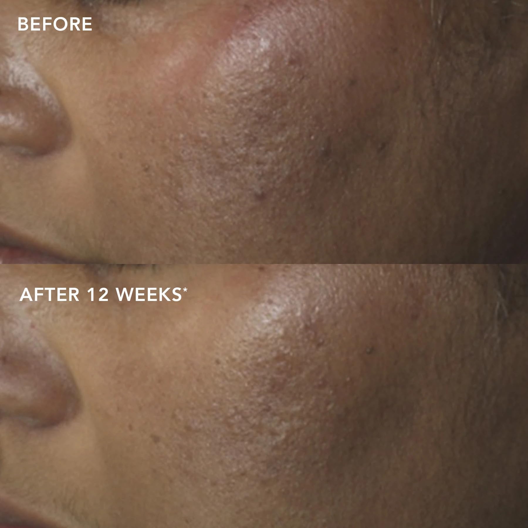 IMAGE Skincare in a bathroom routine setting, illustrates daily morning application benefit