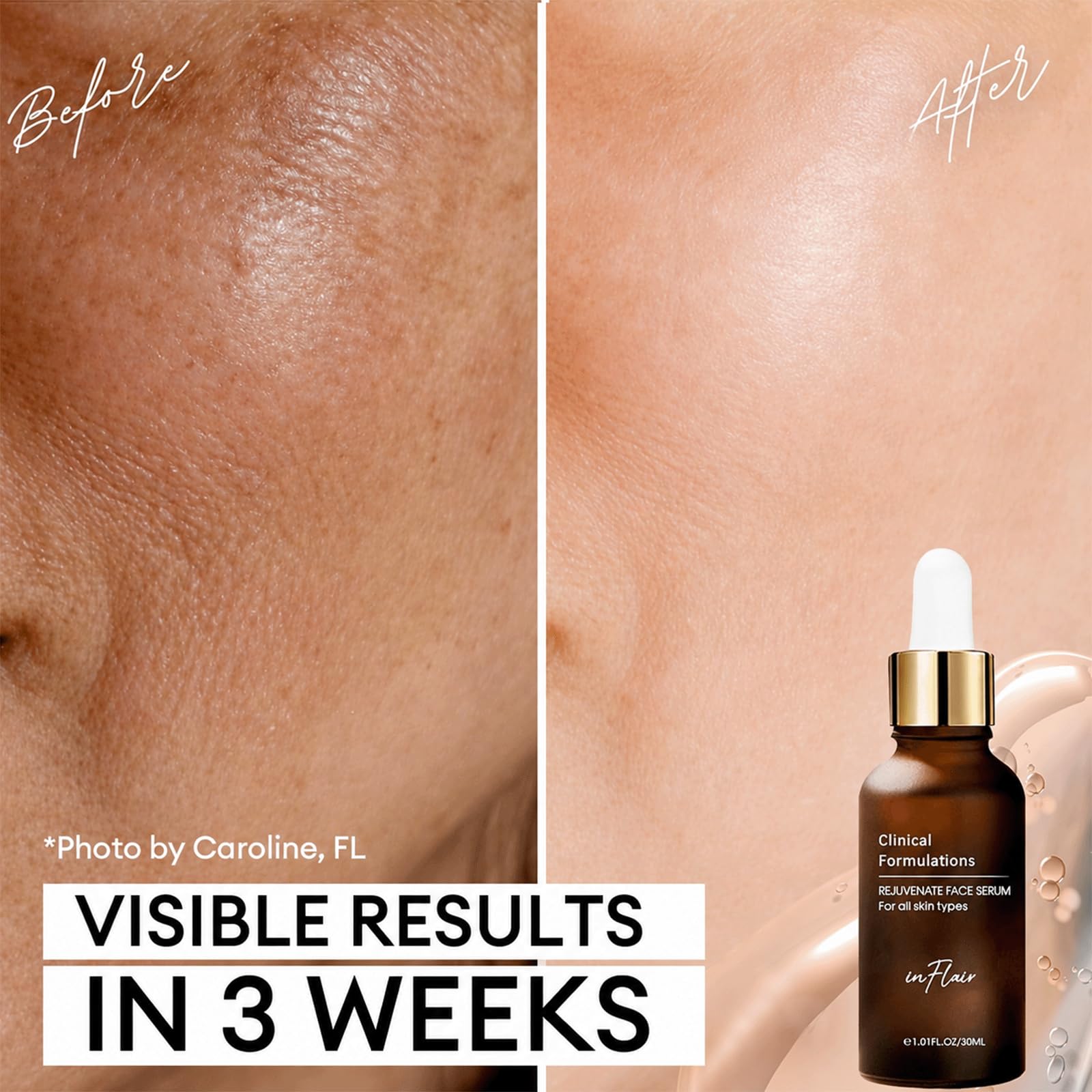 Inflair dropper dispensing clear serum, demonstrates easy controlled application