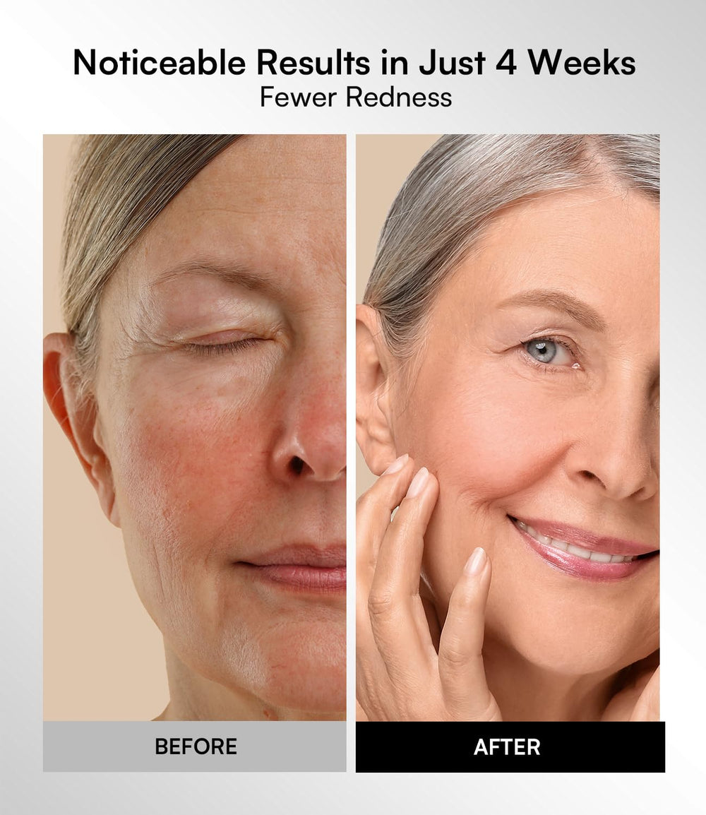 Close-up of cheek with INIA light glow showing targeted illumination and improved radiance