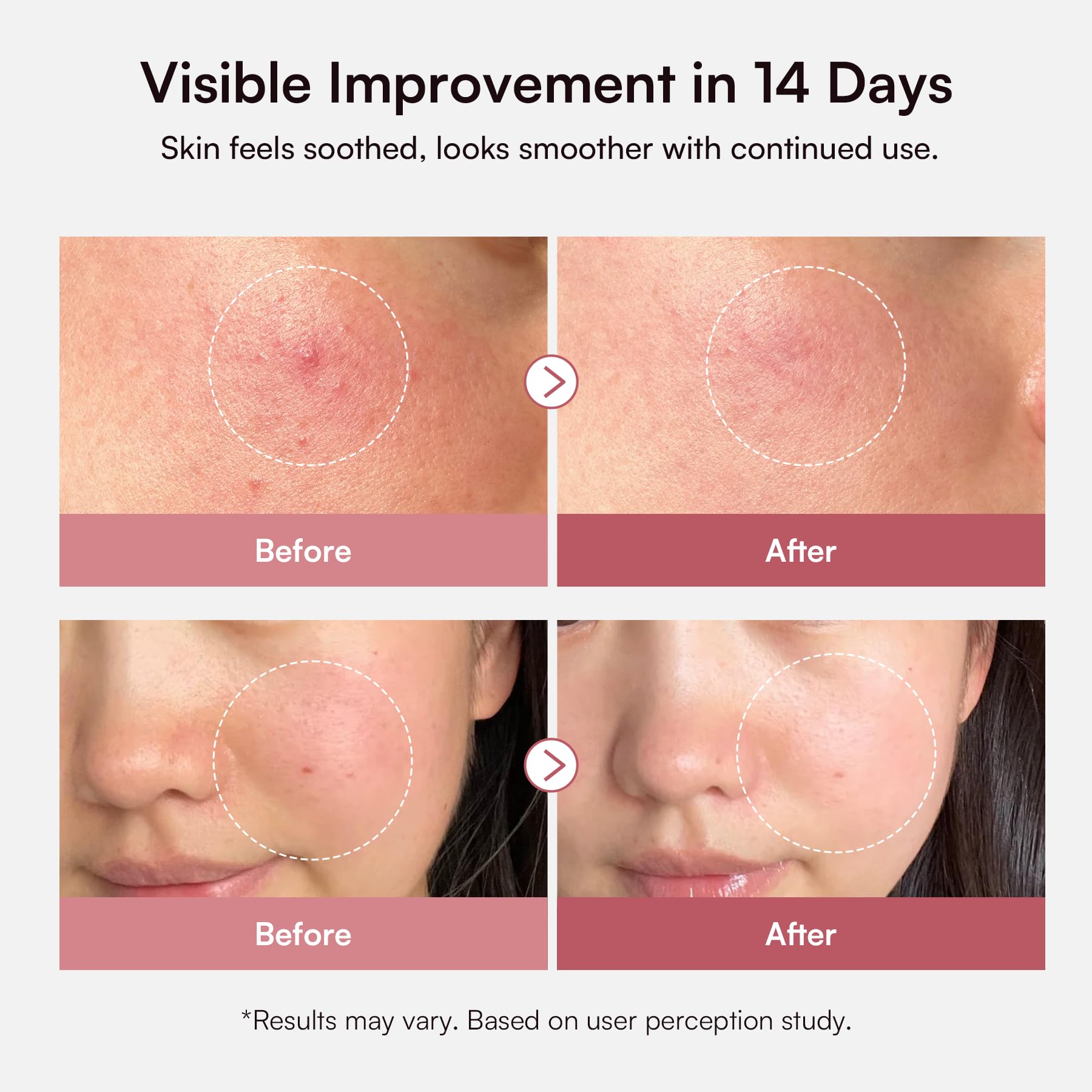 INIA dropper releasing lightweight serum texture for quick absorption
