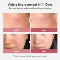 INIA dropper releasing lightweight serum texture for quick absorption