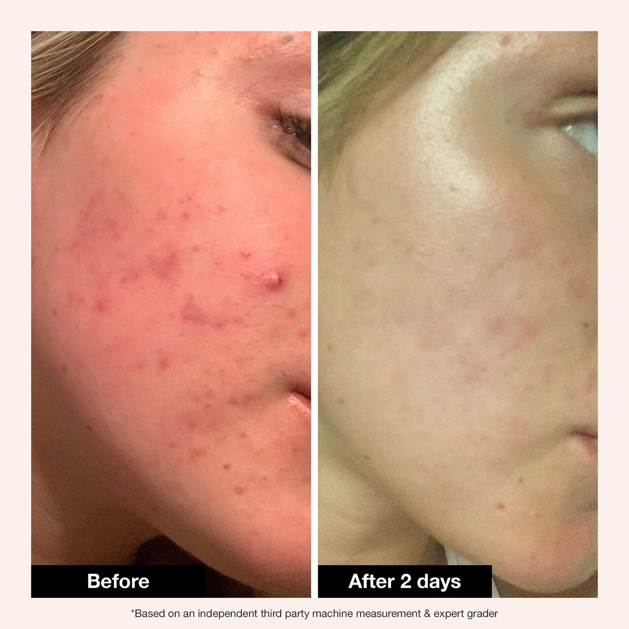 Innbeauty Project applied before sleep in nighttime routine for calming benefit