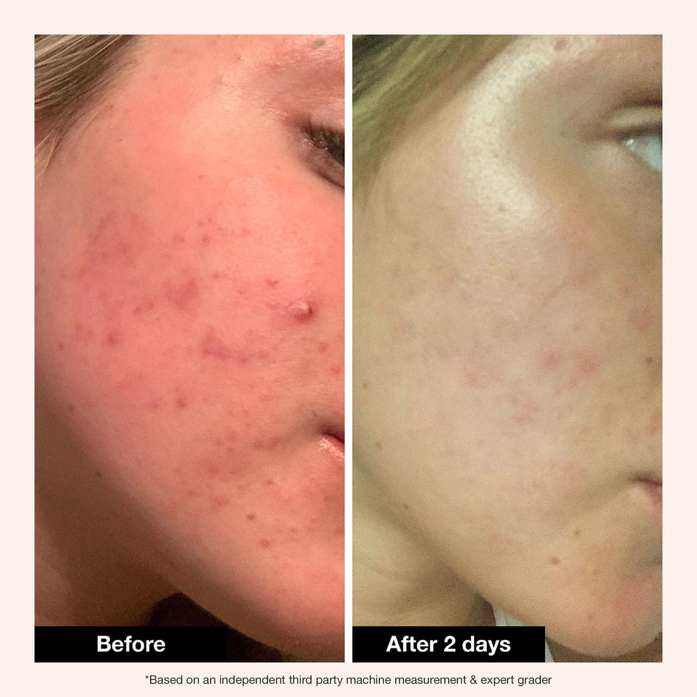 Innbeauty Project applied before sleep in nighttime routine for calming benefit