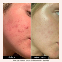 Innbeauty Project applied before sleep in nighttime routine for calming benefit
