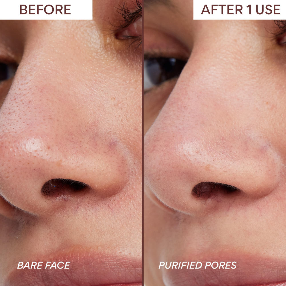 innisfree mask being spread on cheek demonstrating quick ten-minute treatment benefit