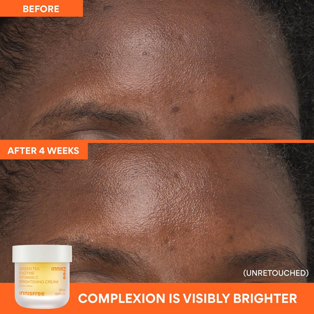 innisfree illustrated before and after concept showing tone improvement