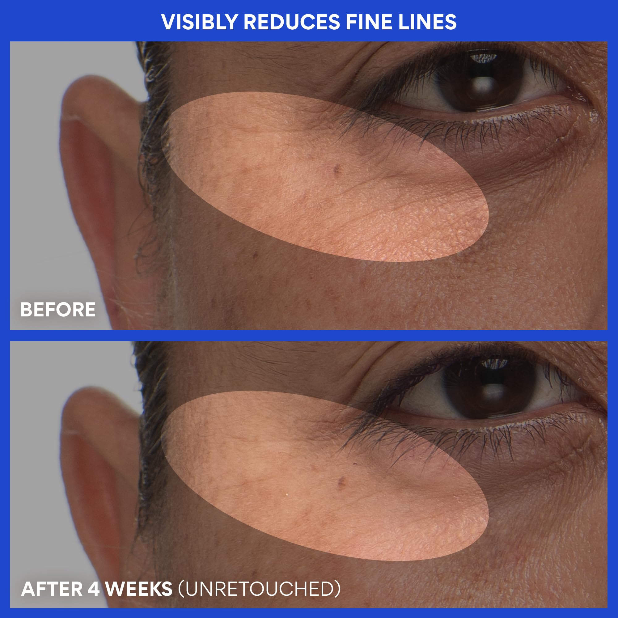 innisfree label detail highlighting Green Tea PDRN and retinol benefit