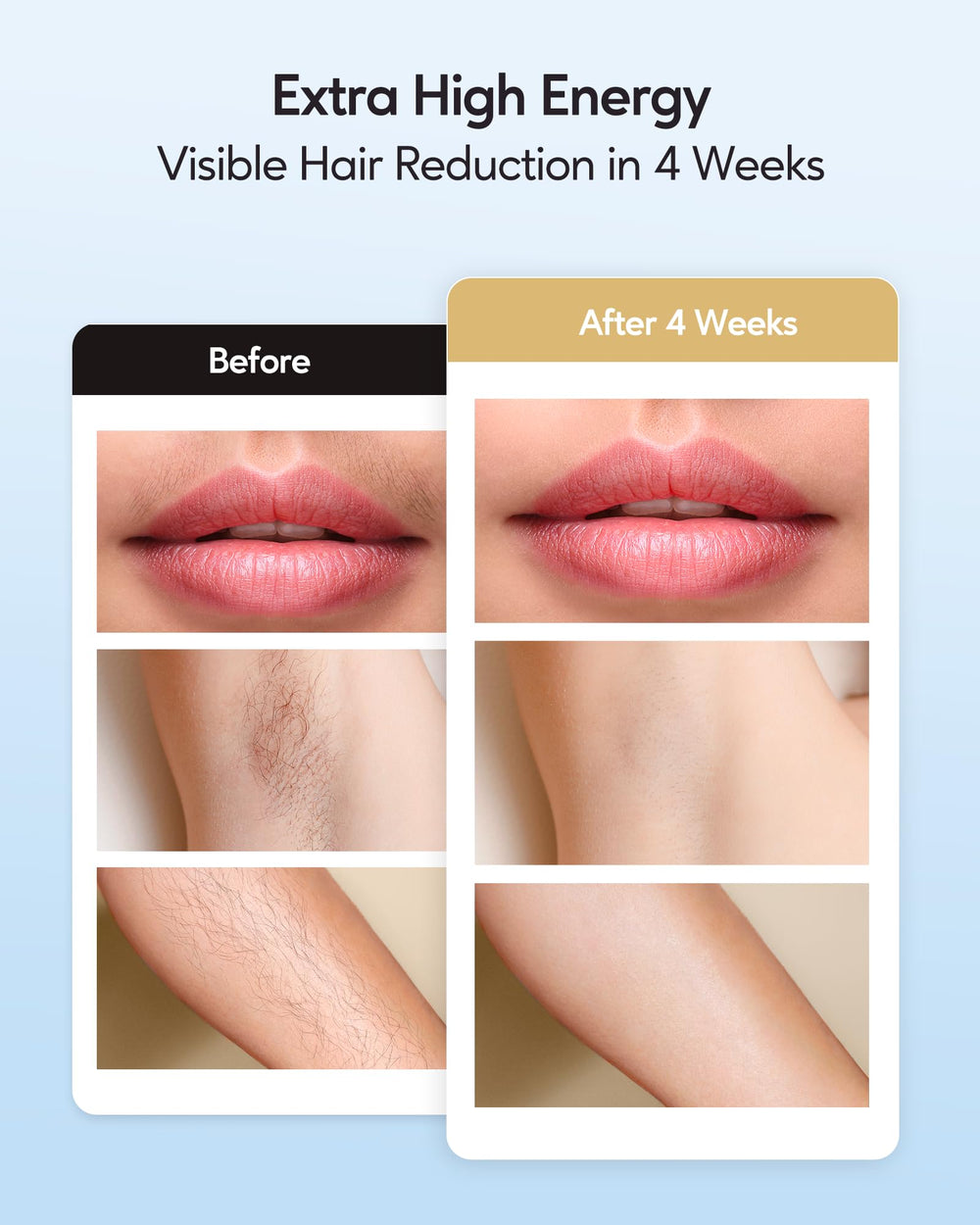 INNZA flash window detail highlighting energy output for effective follicle targeting