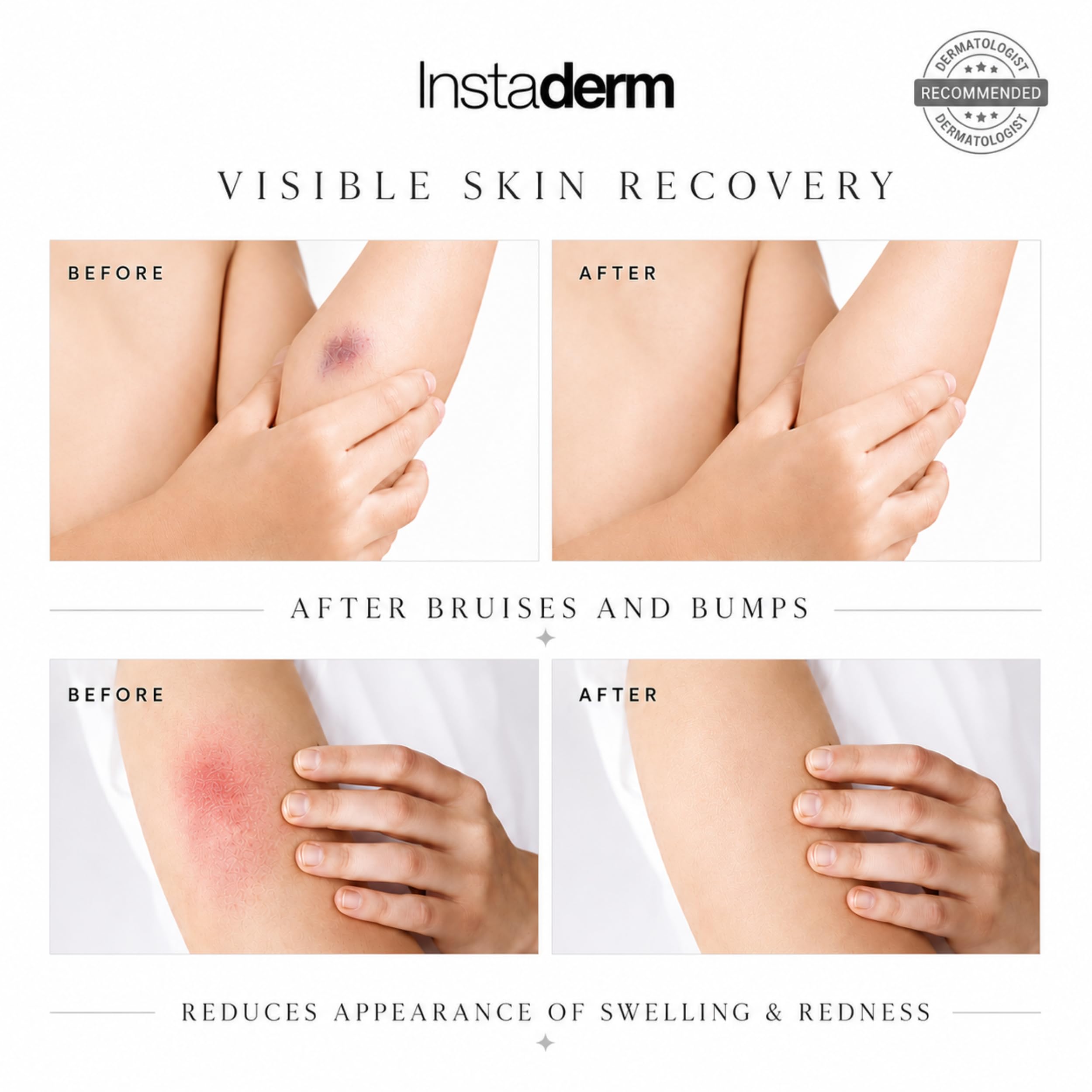 Instaderm ingredients label displaying vitamin K and arnica benefits