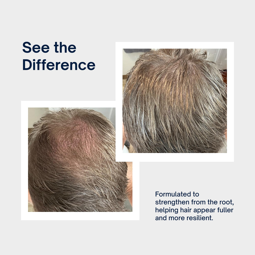 INTELLIGENT simulated before and after showing improved root lift and body