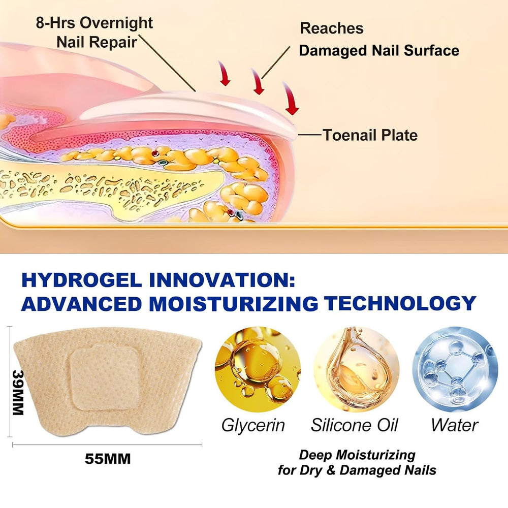 IRSRDOQU patch applied to toenail, demonstrates easy overnight use