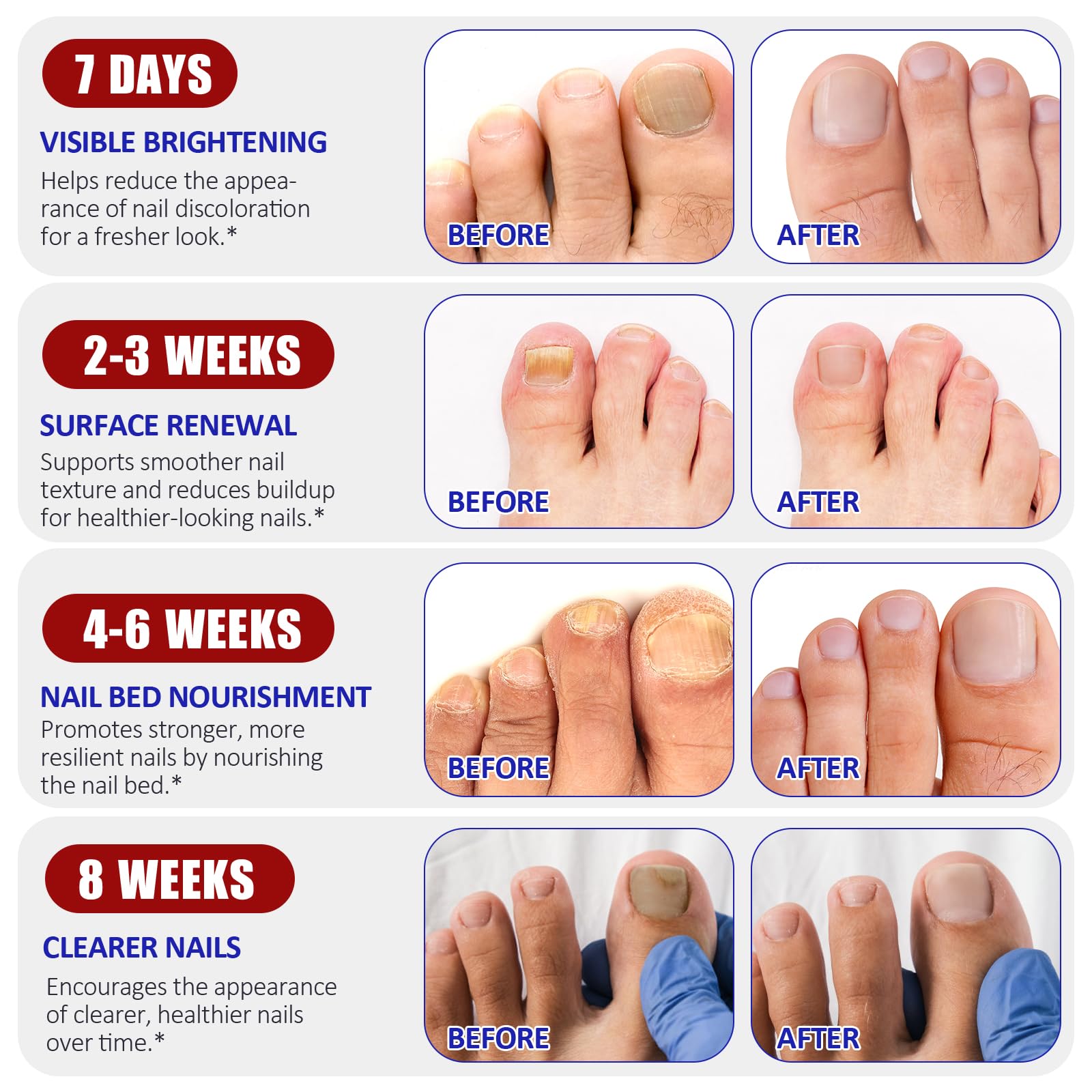 IRSRDOQU patch beside a fingertip for scale, clarifies fit on nails