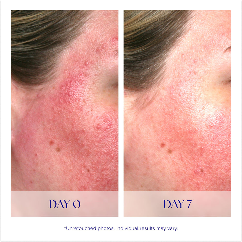 iS CLINICAL bottle next to moisturizer illustrating layering in routine