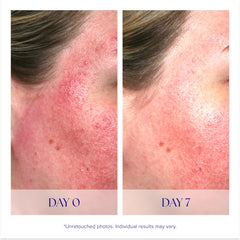 iS CLINICAL bottle next to moisturizer illustrating layering in routine