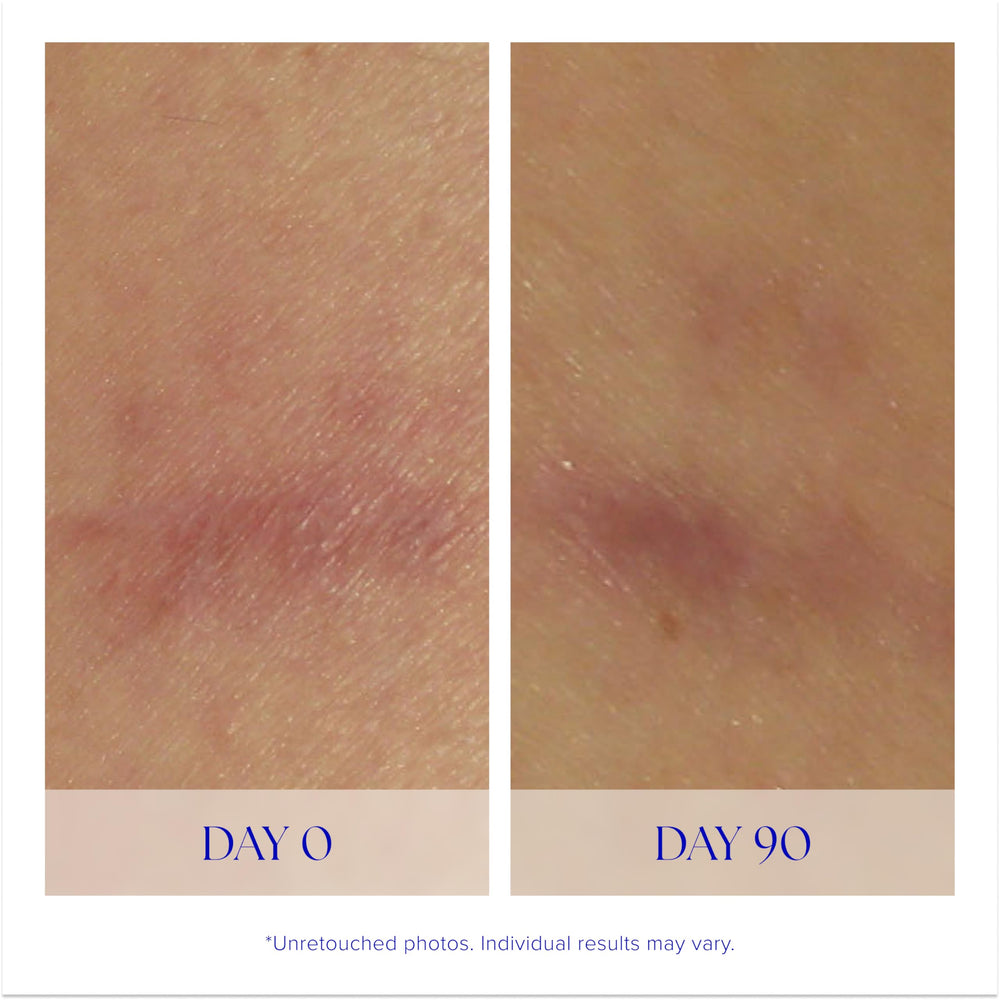 iS CLINICAL serum being applied to hand, illustrates smooth coverage and quick absorption benefit
