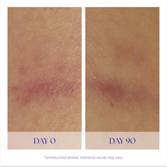 iS CLINICAL serum being applied to hand, illustrates smooth coverage and quick absorption benefit