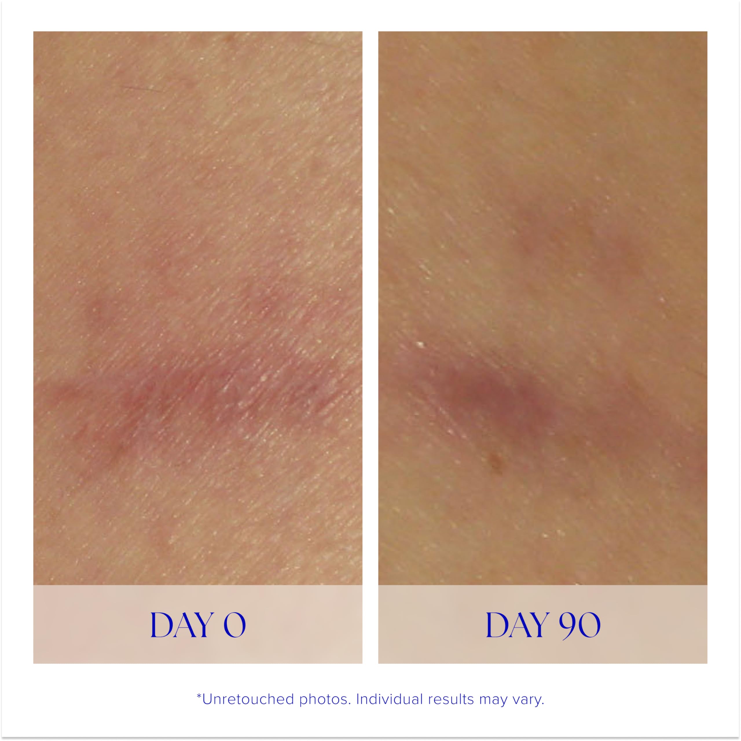 iS CLINICAL held in hand to show one-ounce scale for sizing and travel-friendly benefit