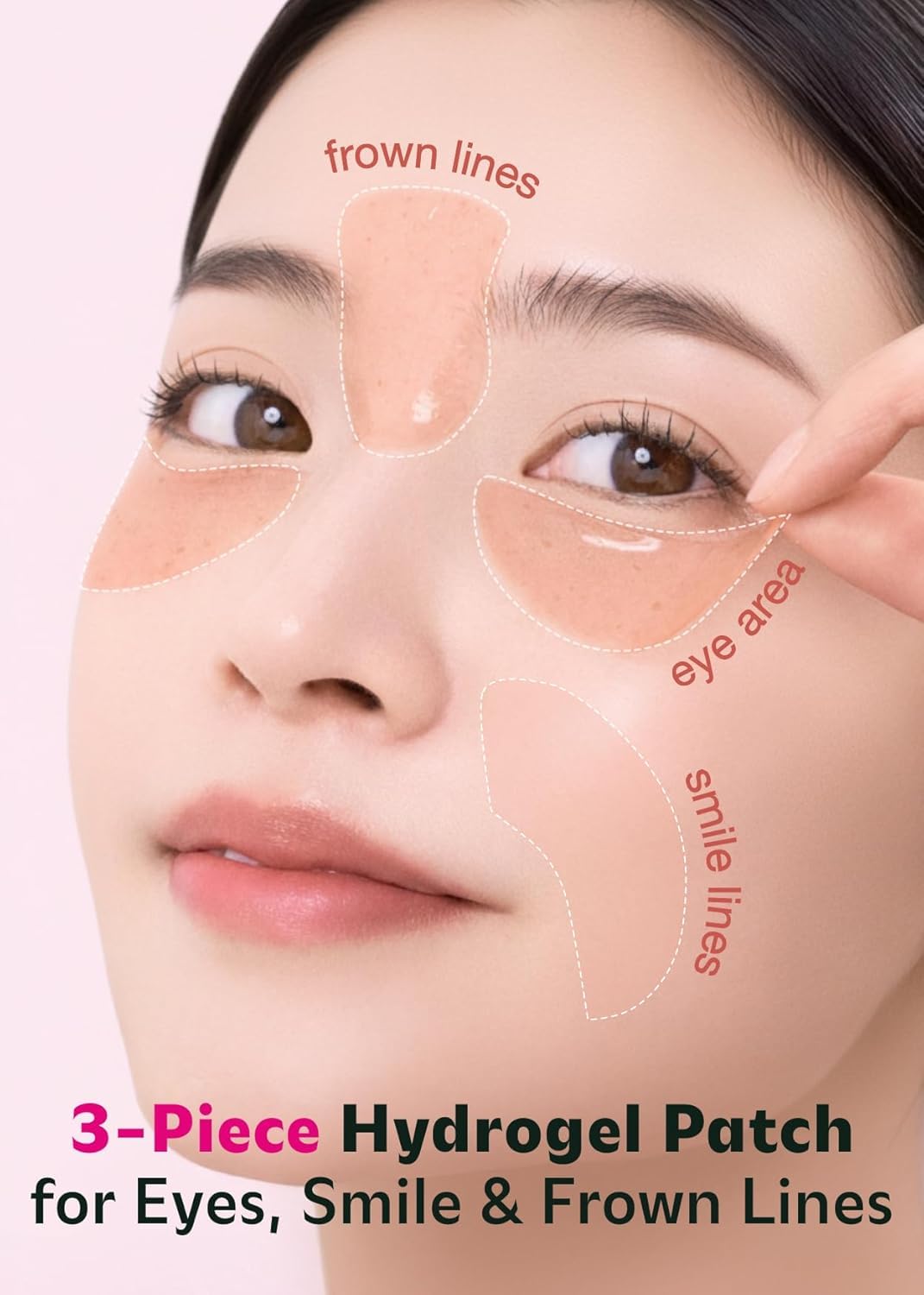 ISOI patch on forehead and smile line area illustrating multi-zone use and smoothing